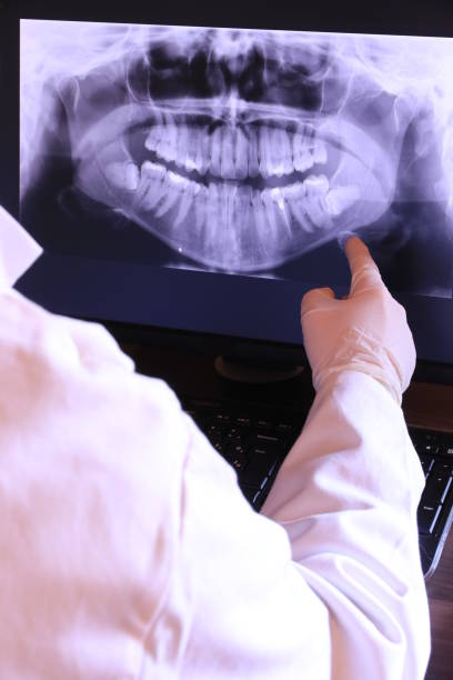 Best Emergency Root Canal Treatment in Tega Cay, SC